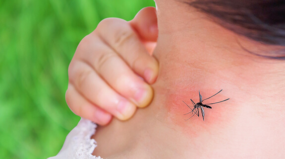 Ein Kind wird von einer Mücke gestochen